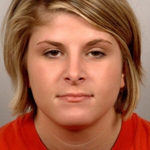 Case--7933 | After Rhinoplasty 1