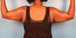 Case--5332 | Before Body 2