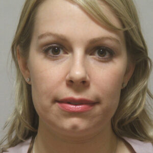 Case--1634 | Before Rhinoplasty 1