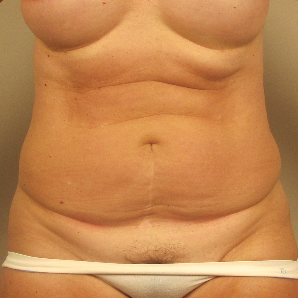 Case--3096 | Before Body