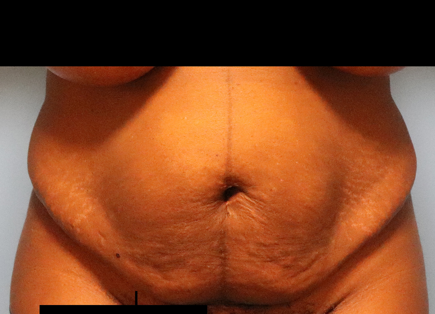 Case--3061 | Before Body