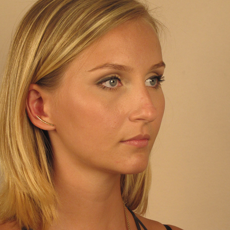 Case--2379 | Before Rhinoplasty 2