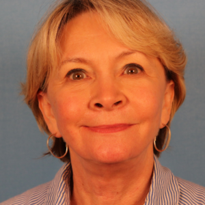 Frontal postoperative view of a female patient after facelift surgery showing improved facial definition, smoother contours, and enhanced jawline appearance at a plastic surgery practice in Montgomery, Alabama.