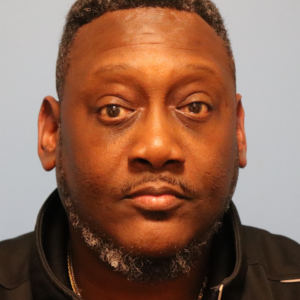Front view after male lower blepharoplasty by Dr. Bentley in Montgomery, AL.