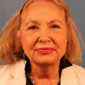 Preoperative frontal view of a female patient before facelift surgery showing facial aging, skin laxity, and loss of jawline definition at a plastic surgery practice in Montgomery, Alabama.