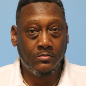 Front view before male lower blepharoplasty by Dr. Bentley in Montgomery, AL.