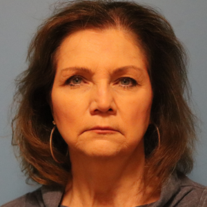 Front view before endoscopic brow lift and upper and lower blepharoplasty by Dr. Bentley in Montgomery, AL.