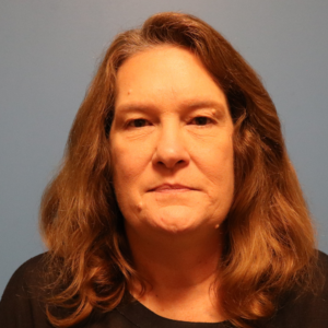Front view before endoscopic brow lift with upper and lower blepharoplasty by Dr. Bentley in Montgomery, AL.
