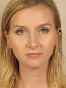 Case--51764 | After Face 1